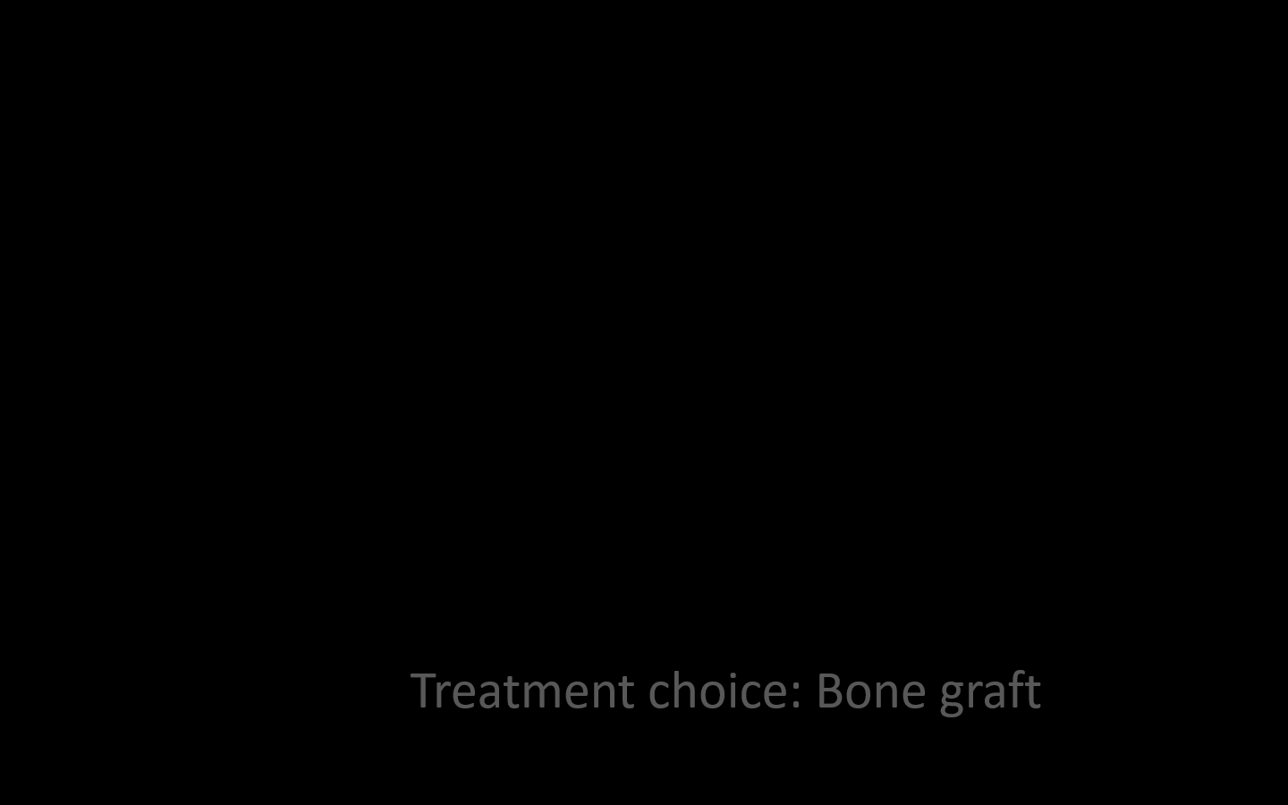 05_3rd_bone-graft-choice_pan-asia-ots_cyyang